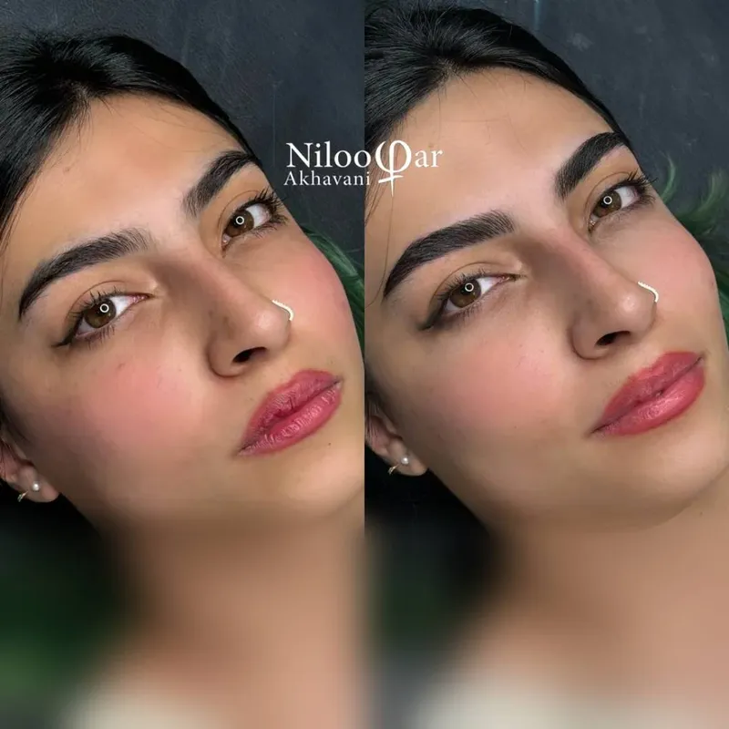 فیبروز ابرو